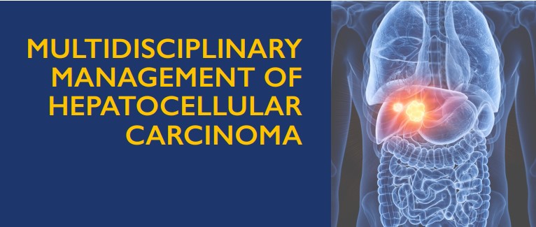 Multidisciplinary Management of Hepatocellular Carcinoma Banner